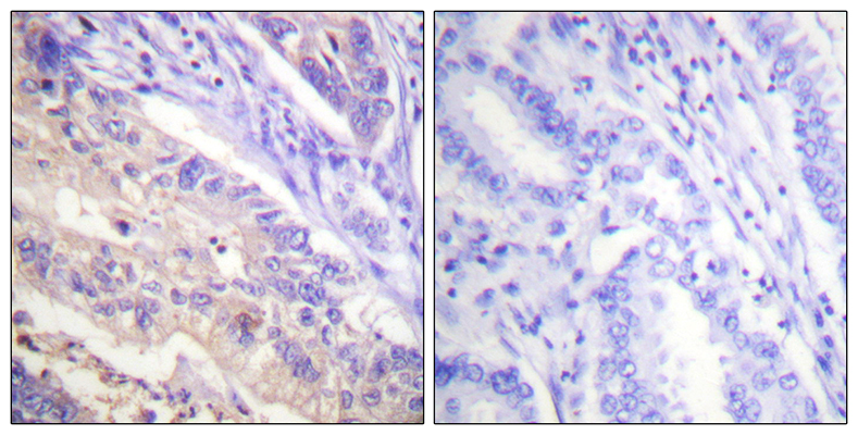 PTEN (phospho Ser385) Rabbit Polyclonal Antibody | 兔多抗 | EnkiLife恩玑生命