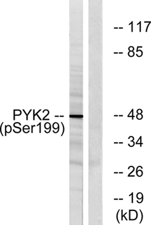 PYK2 (phospho Tyr402) Rabbit Polyclonal Antibody | 兔多抗 | EnkiLife恩玑生命