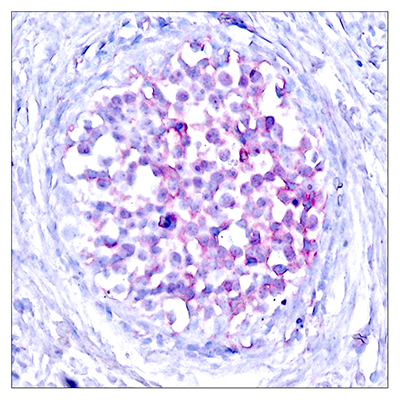 Raf-1 (phospho Ser259) Rabbit Polyclonal Antibody | 兔多抗 | EnkiLife恩玑生命