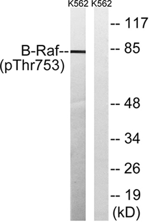 Raf-B (phospho Thr753) Rabbit Polyclonal Antibody | 兔多抗 | EnkiLife恩玑生命