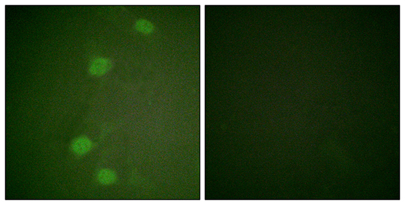 Rb (phospho Ser249) Rabbit Polyclonal Antibody | 兔多抗 | EnkiLife恩玑生命