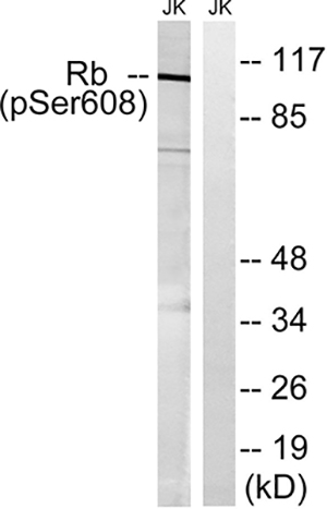 Rb (phospho Ser608) Rabbit Polyclonal Antibody | 兔多抗 | EnkiLife恩玑生命