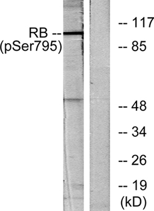 Rb (phospho Ser795) Rabbit Polyclonal Antibody | 兔多抗 | EnkiLife恩玑生命