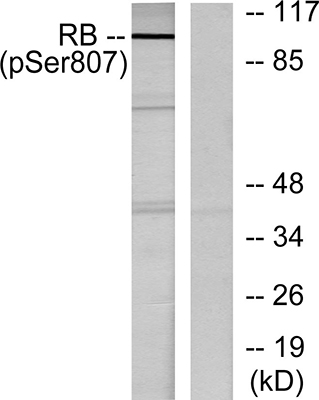 Rb (phospho Ser807) Rabbit Polyclonal Antibody | 兔多抗 | EnkiLife恩玑生命