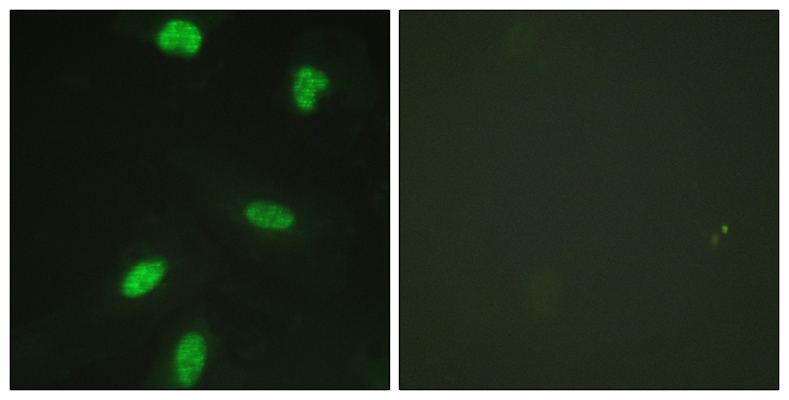 Rb (phospho Thr821) Rabbit Polyclonal Antibody | 兔多抗 | EnkiLife恩玑生命