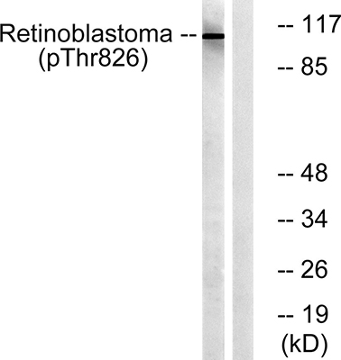 Rb (phospho Thr826) Rabbit Polyclonal Antibody | 兔多抗 | EnkiLife恩玑生命