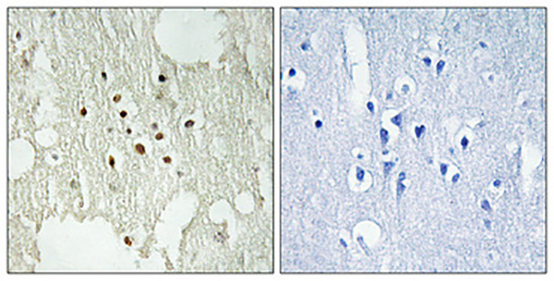 Rb (phospho Thr826) Rabbit Polyclonal Antibody | 兔多抗 | EnkiLife恩玑生命