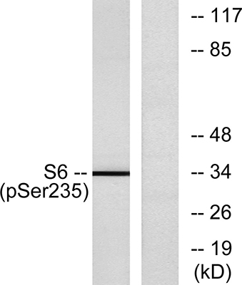 Ribosomal Protein S6 (phospho Ser235) Rabbit Polyclonal Antibody | 兔多抗 | EnkiLife恩玑生命