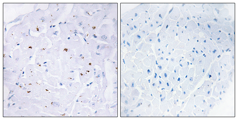 Smad3 (phospho Thr179) Rabbit Polyclonal Antibody | 兔多抗 | EnkiLife恩玑生命