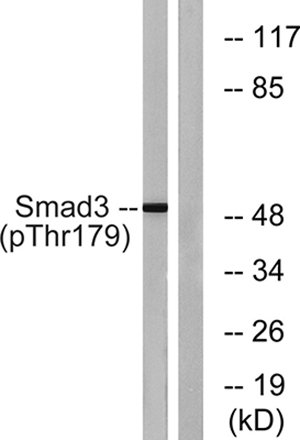 Smad3 (phospho Thr179) Rabbit Polyclonal Antibody | 兔多抗 | EnkiLife恩玑生命