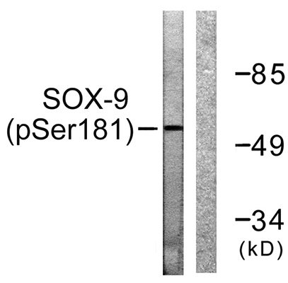 Sox-9 (phospho Ser181) Rabbit Polyclonal Antibody | 兔多抗 | EnkiLife恩玑生命