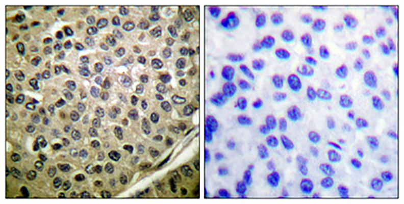 Stat4 (phospho Tyr693) Rabbit Polyclonal Antibody | 兔多抗 | EnkiLife恩玑生命
