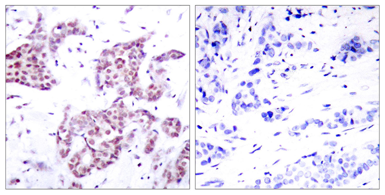 Stat6 (phospho Tyr641) Rabbit Polyclonal Antibody | 兔多抗 | EnkiLife恩玑生命