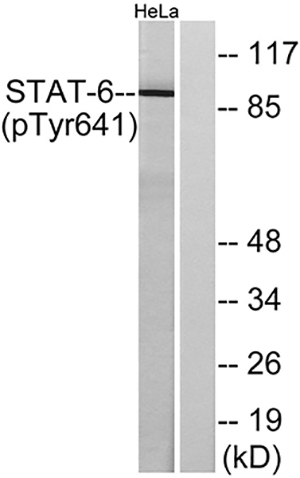 Stat6 (phospho Tyr641) Rabbit Polyclonal Antibody | 兔多抗 | EnkiLife恩玑生命