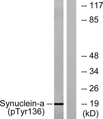 Synuclein-α (phospho Tyr136) Rabbit Polyclonal Antibody | 兔多抗 | EnkiLife恩玑生命