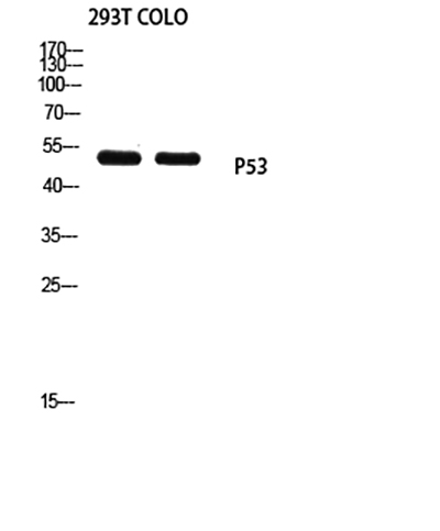 p53 (Mono Methyl Lys370) Rabbit Polyclonal Antibody | 兔多抗 | EnkiLife恩玑生命