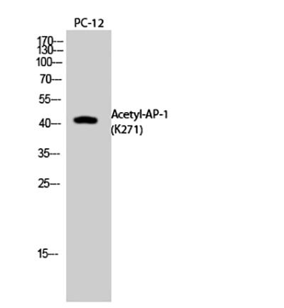 AP-1 (Acetyl Lys271) Rabbit Polyclonal Antibody | 兔多抗 | EnkiLife恩玑生命