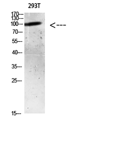 AR (Acetyl Lys633) Rabbit Polyclonal Antibody | 兔多抗 | EnkiLife恩玑生命