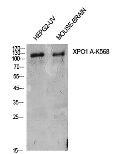 CRM1 (Acetyl Lys568) Rabbit Polyclonal Antibody | 兔多抗 | EnkiLife恩玑生命