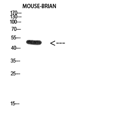 E2F-1 (Acetyl-Lys120) Rabbit Polyclonal Antibody | 兔多抗 | EnkiLife恩玑生命