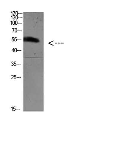 FoxO4 (Acetyl Lys189) Rabbit Polyclonal Antibody | 兔多抗 | EnkiLife恩玑生命