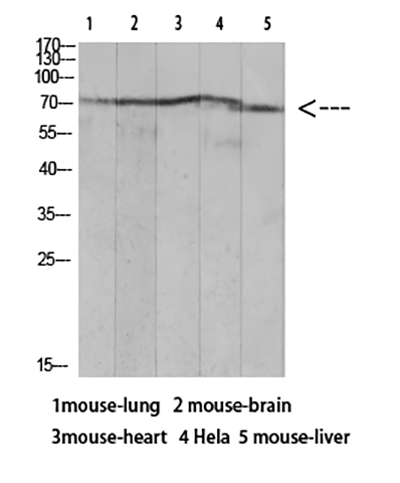 Ku-70 (Acetyl Lys317) Rabbit Polyclonal Antibody | 兔多抗 | EnkiLife恩玑生命