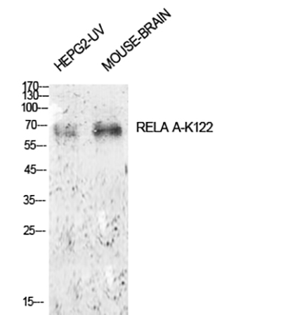 NFκB-p65 (Acetyl Lys122) Rabbit Polyclonal Antibody | 兔多抗 | EnkiLife恩玑生命