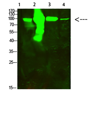 ACO2 Rabbit Polyclonal Antibody | 兔多抗 | EnkiLife恩玑生命