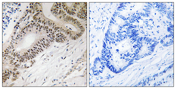 FoxO3A Rabbit Polyclonal Antibody | 兔多抗 | EnkiLife恩玑生命