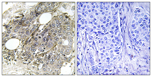 TGFβ RIII Rabbit Polyclonal Antibody | 兔多抗 | EnkiLife恩玑生命