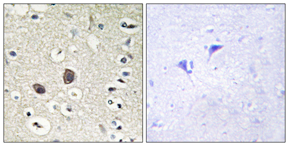 Tie-2 Rabbit Polyclonal Antibody | 兔多抗 | EnkiLife恩玑生命