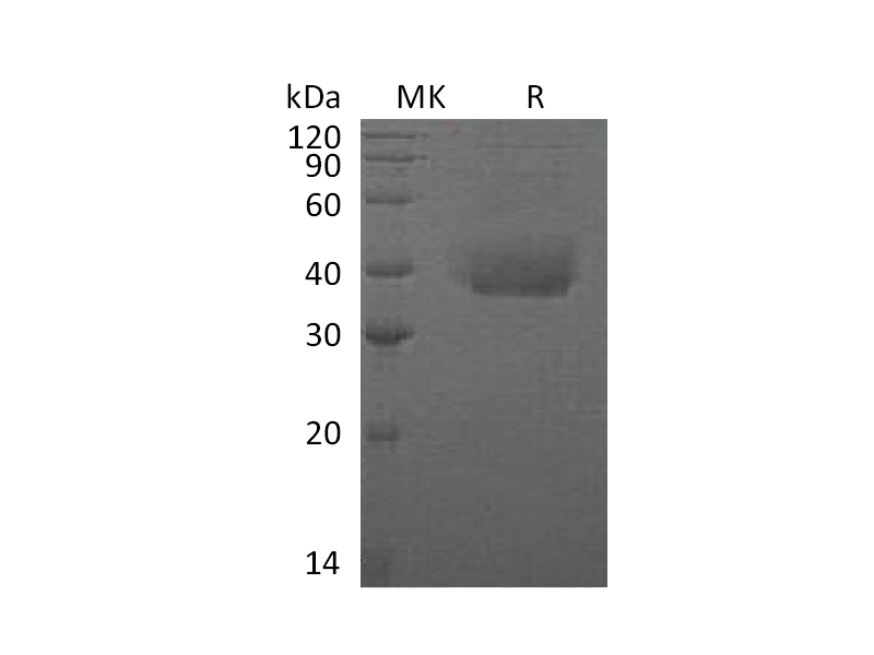 重组人ANTXR1 (C-6His)蛋白 | EnkiLife恩玑生命