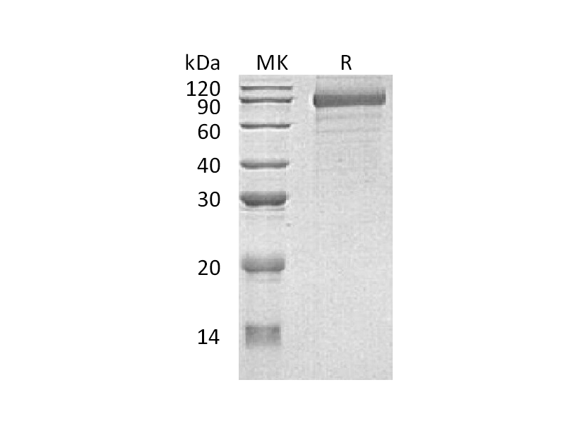 重组人CDH8 (C-6His)蛋白 | EnkiLife恩玑生命