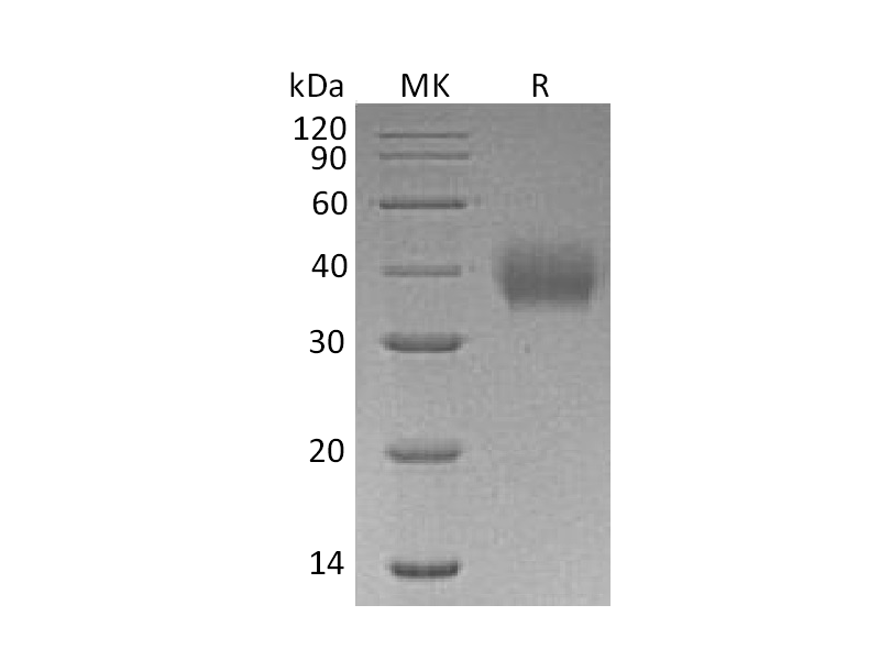 重组人FcAR (C-6His)蛋白 | EnkiLife恩玑生命