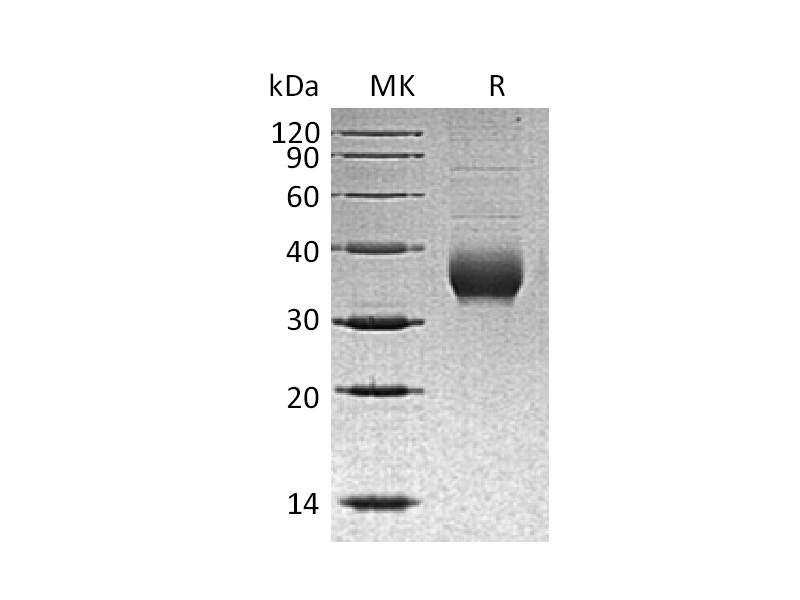 重组人CHRNB3 (C-6His)蛋白 | EnkiLife恩玑生命