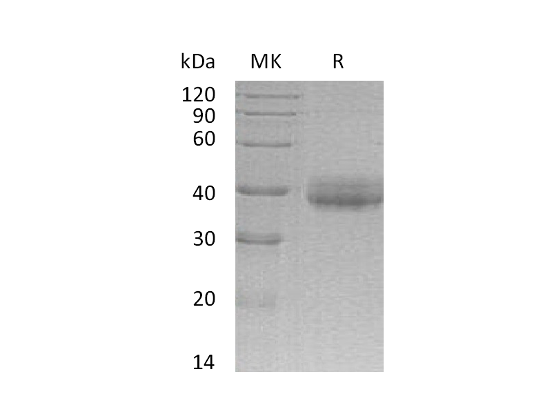 重组人CRELD2 (C-6His)蛋白 | EnkiLife恩玑生命