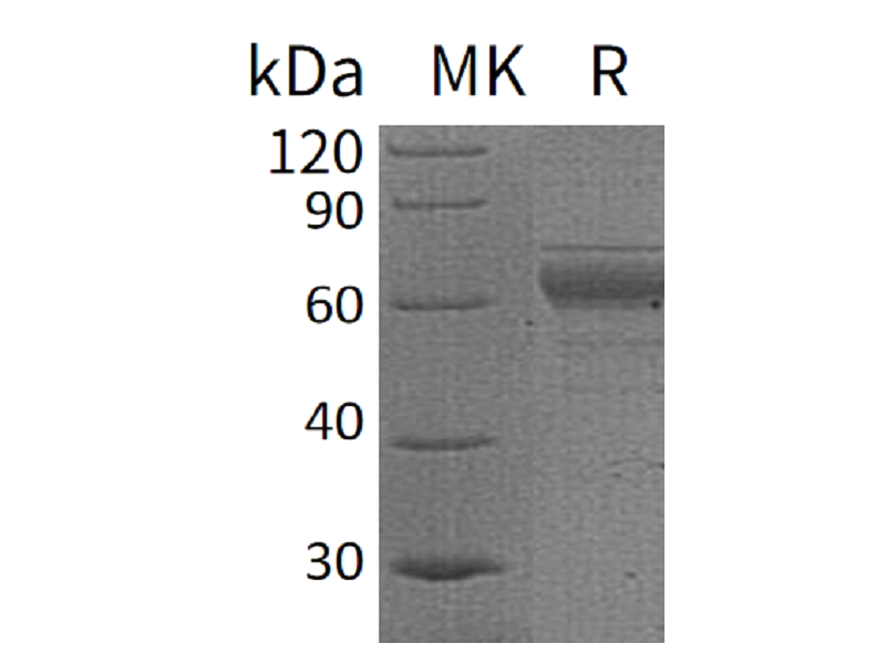 重组人IL-20RB (C-Fc)蛋白 | EnkiLife恩玑生命