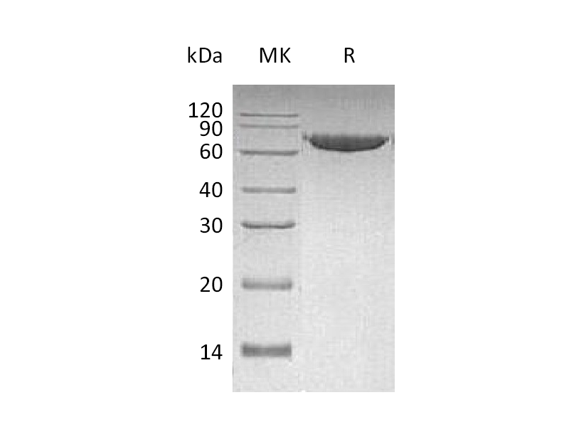 重组人MMP-2 (C-6His)蛋白 | EnkiLife恩玑生命
