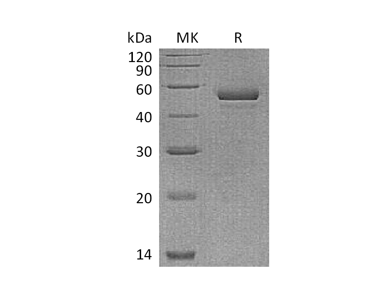 重组人NPTX1 (C-6His)蛋白 | EnkiLife恩玑生命