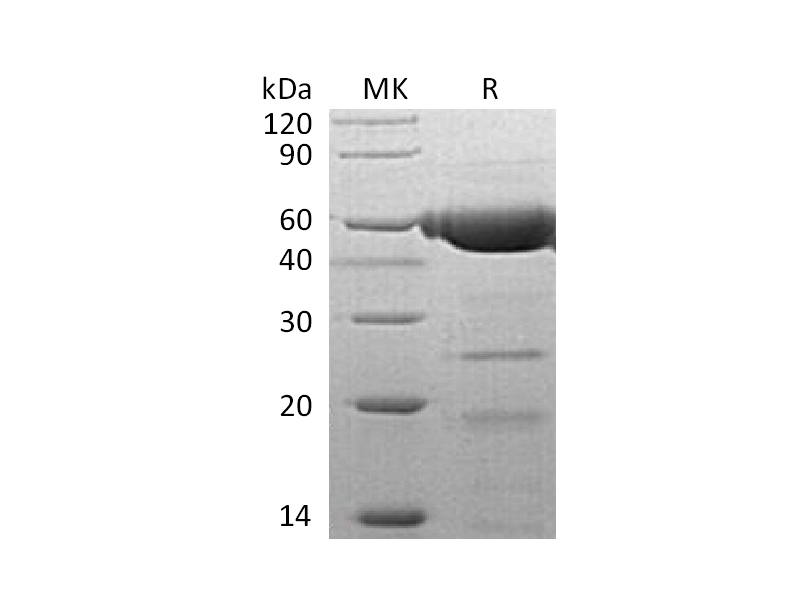 重组人PLRP2 (C-6His)蛋白 | EnkiLife恩玑生命