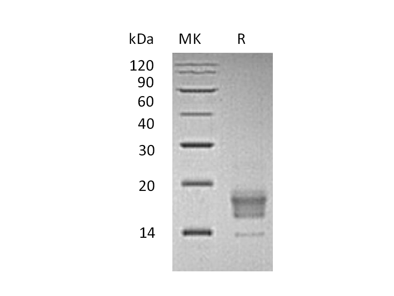 重组人TIGIT (C-6His)蛋白 | EnkiLife恩玑生命