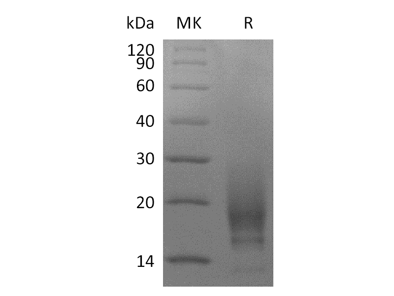 重组人CD63 (N-6His)蛋白 | EnkiLife恩玑生命