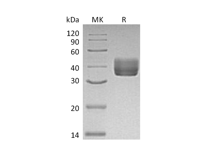 重组小鼠CD157 (C-6His)蛋白 | EnkiLife恩玑生命