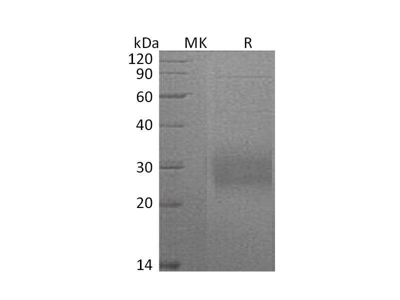 重组小鼠CD74 (C-6His)蛋白 | EnkiLife恩玑生命