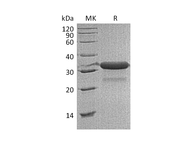 重组小鼠IGFBP-7 (C-6His)蛋白 | EnkiLife恩玑生命