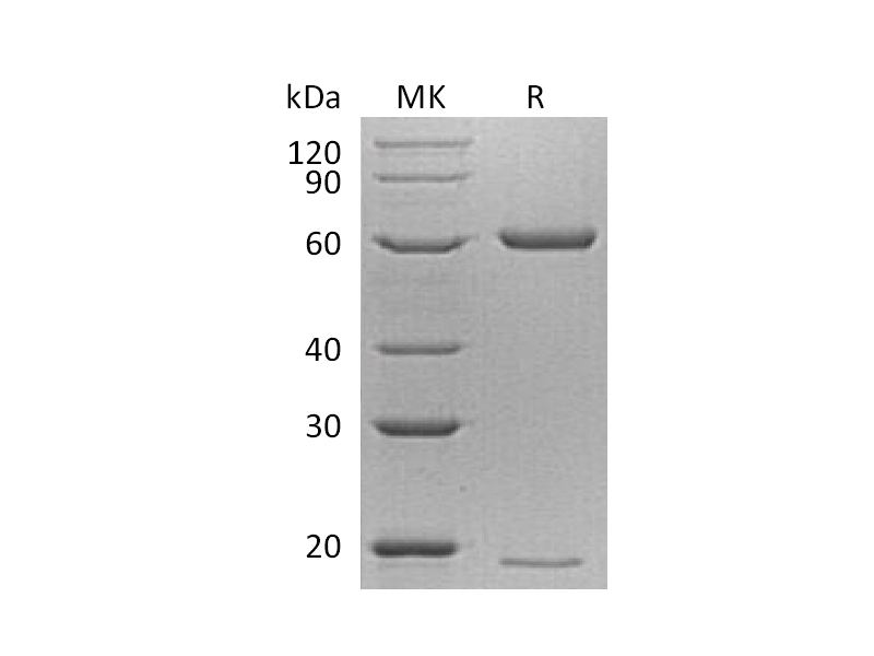 重组小鼠PCSK9 (C-6His)蛋白 | EnkiLife恩玑生命