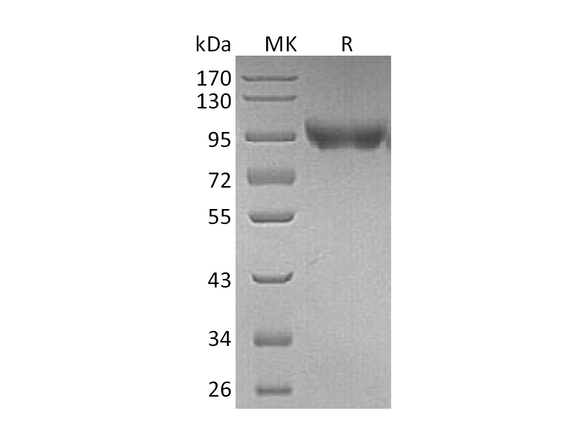重组小鼠CD31 (C-6His)蛋白 | EnkiLife恩玑生命