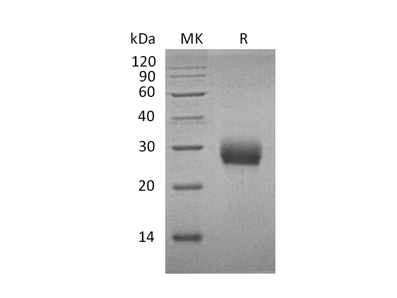 重组小鼠RANK (C-6His)蛋白 | EnkiLife恩玑生命