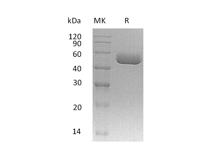 重组小鼠Serpin A1a (C-6His, AAC28869.1 )蛋白 | EnkiLife恩玑生命