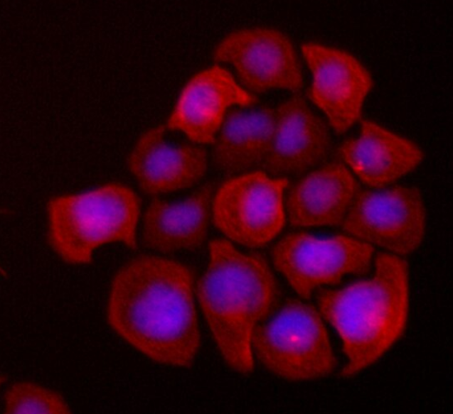 大鼠冠状动脉平滑肌细胞